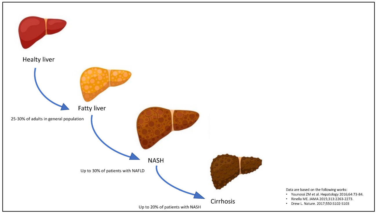 tyrolean liver